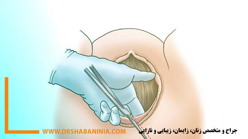 بهترین-پزشک-زنان-اصفهان