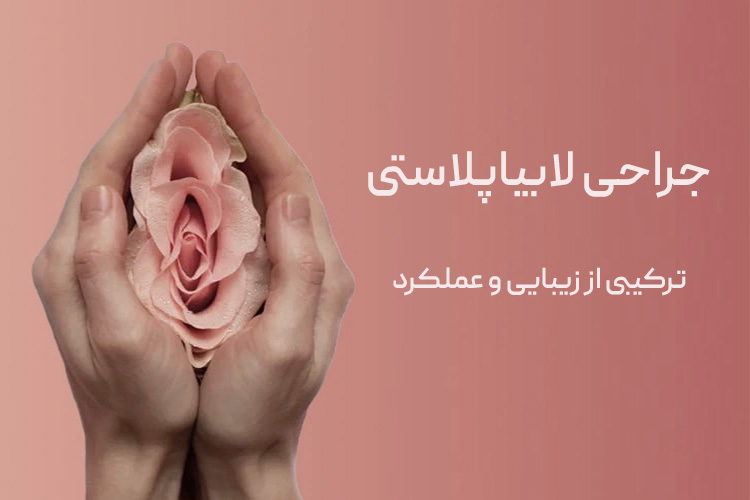 لابیاپلاستی